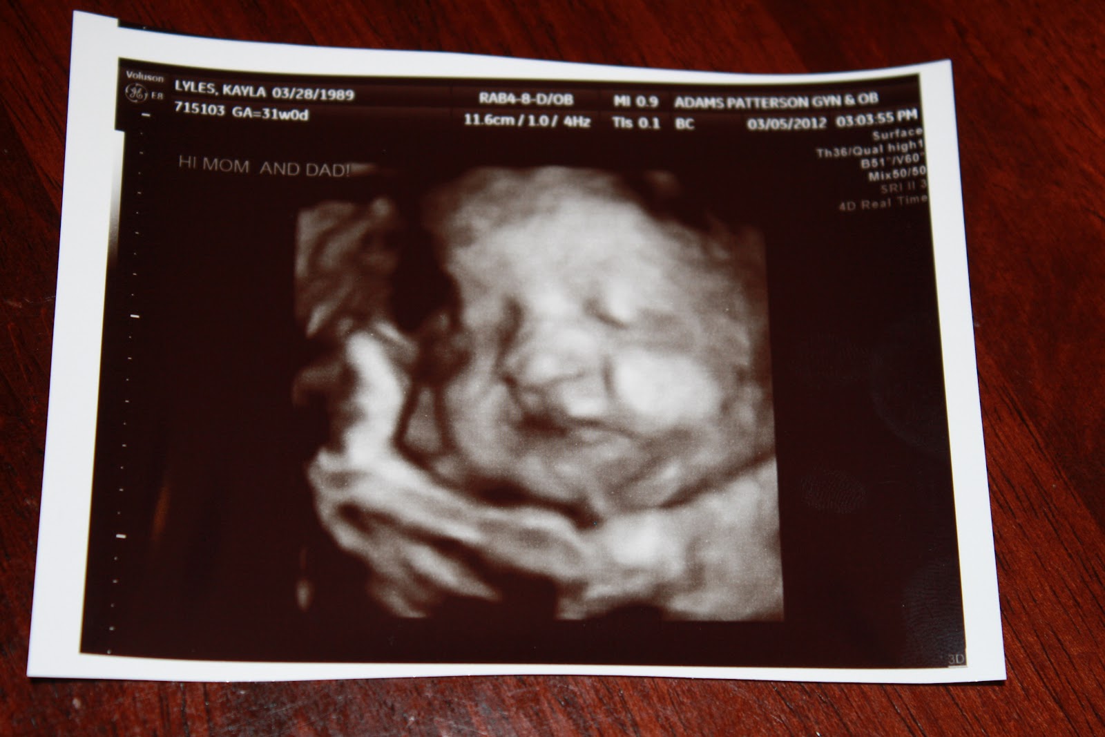 32 неделя беременности мало. Снимок УЗИ 32 недели беременности. Фото УЗИ 32 недели беременности. 31 Неделя беременности фото УЗИ ребенка. УЗИ ребенка в животе.
